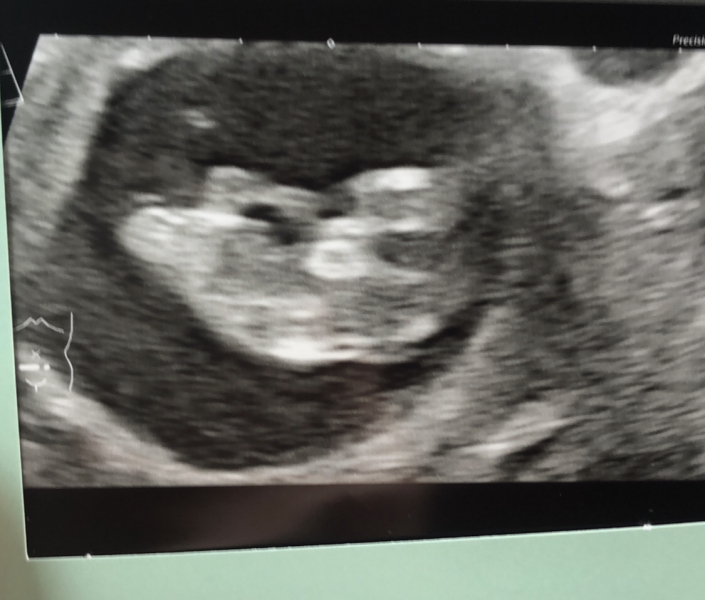 OCTOBER 2024 BABIES :) THREAD 3