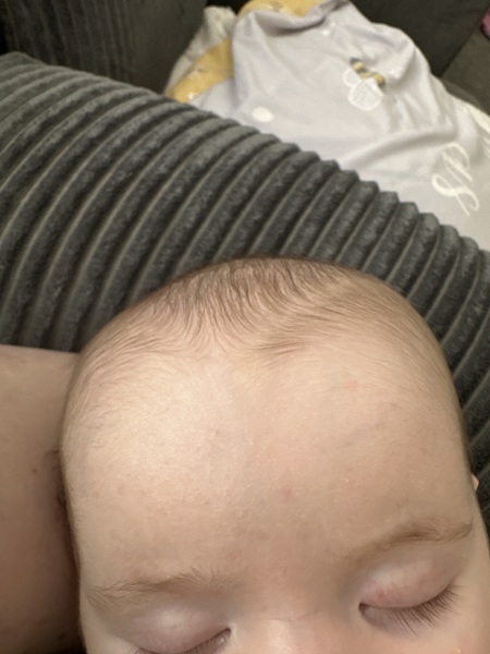 baby with ?cmpa