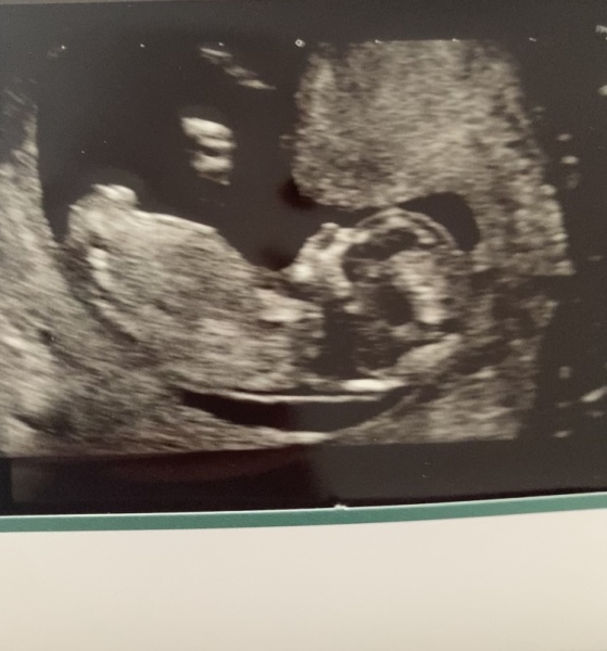 OCTOBER 2024 BABIES :) THREAD 3