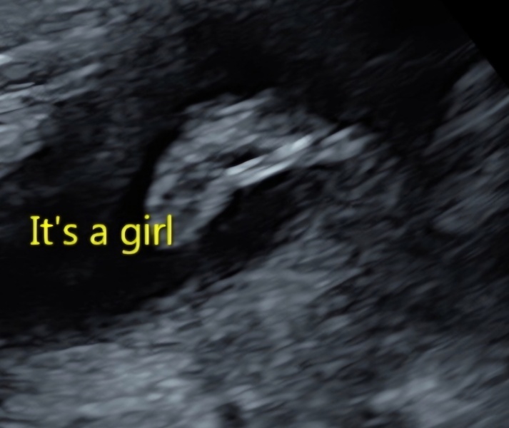 Gender scan