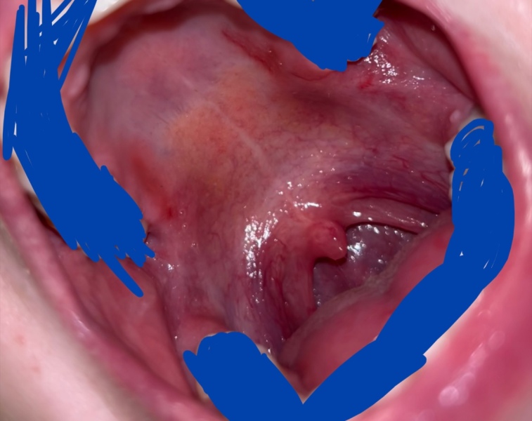 Wtf does my mouth keep doing this?