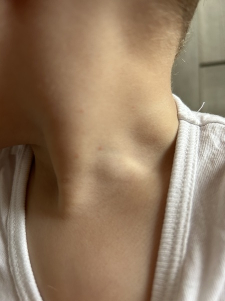 Could this be chicken pox?