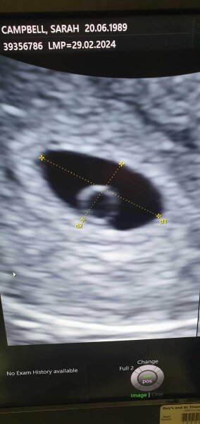 Dec-Christmas Babys 2024