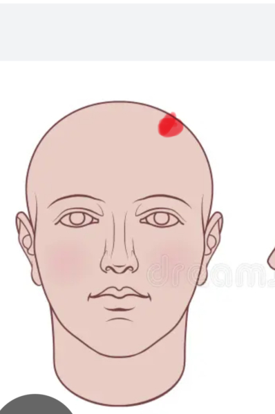 Strange headache keep coming back?