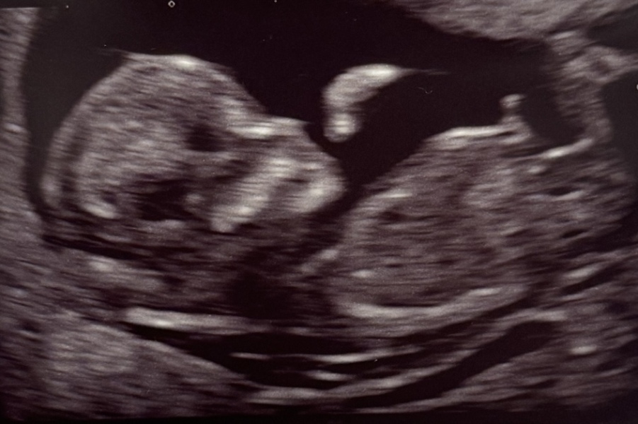 Gender prediction help!