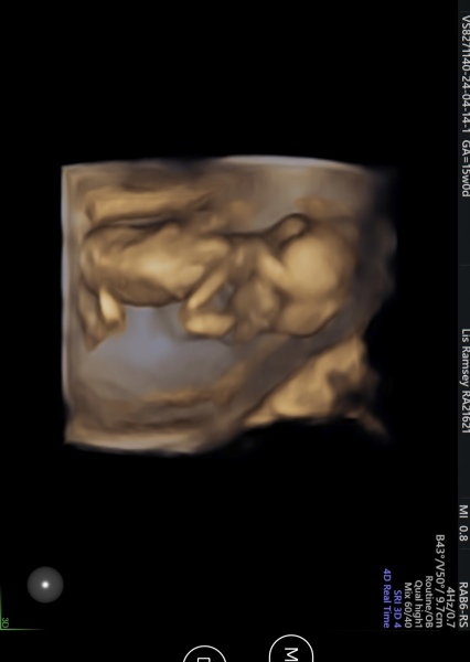 OCTOBER 2024 BABIES :) THREAD 3