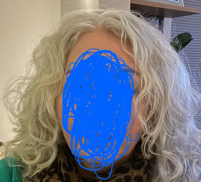 AIMB to embrace the grey?