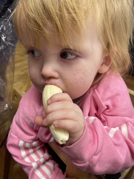 Milk allergy or colic? Warning nappy contents picture