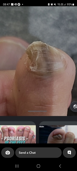 Line on nail