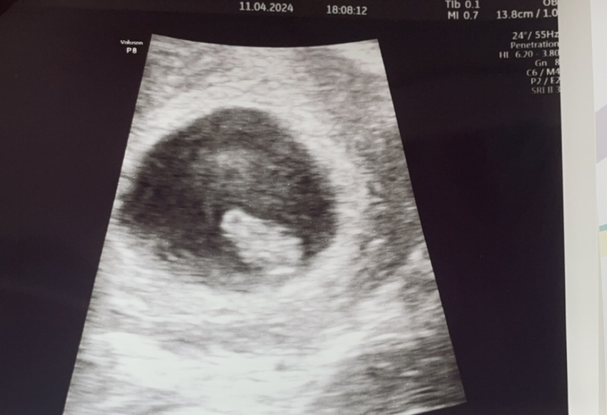November 2024 Babies - thread 3