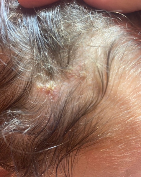Scalp injury ( photos included )