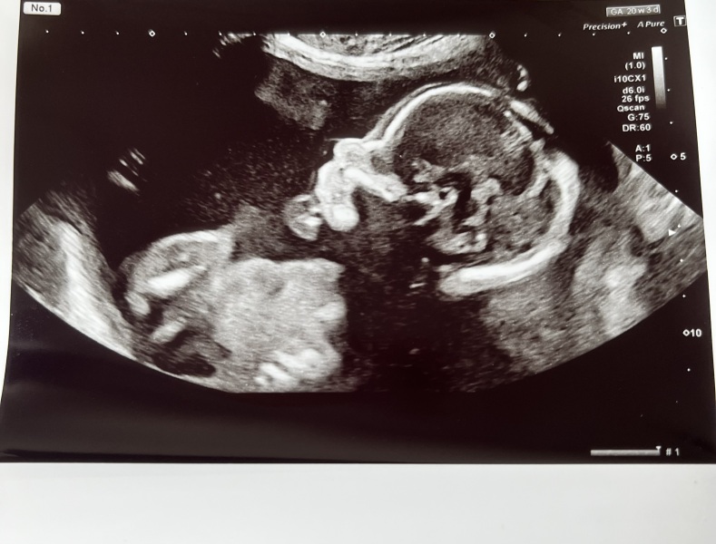 September 2024 - Thread 6! 🐣🧡💛❤️