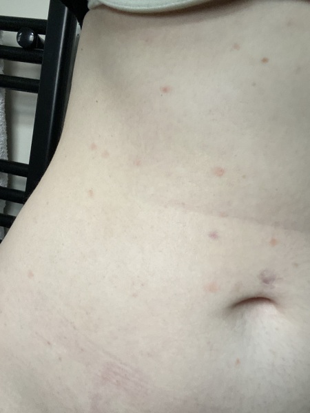 Help me diagnose- IMAGE