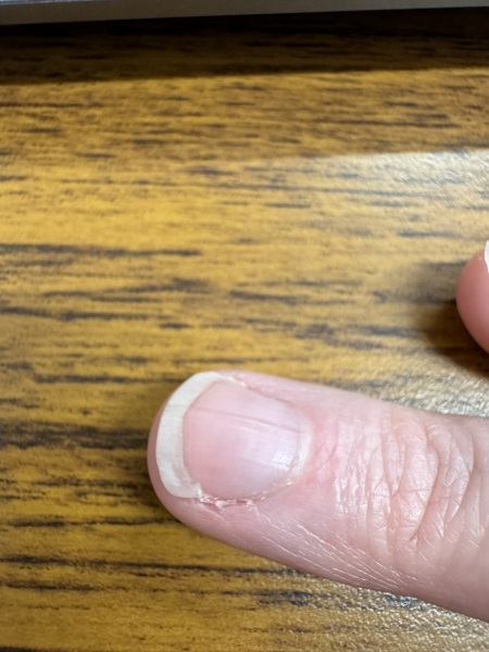 Desperate nail help!!!'