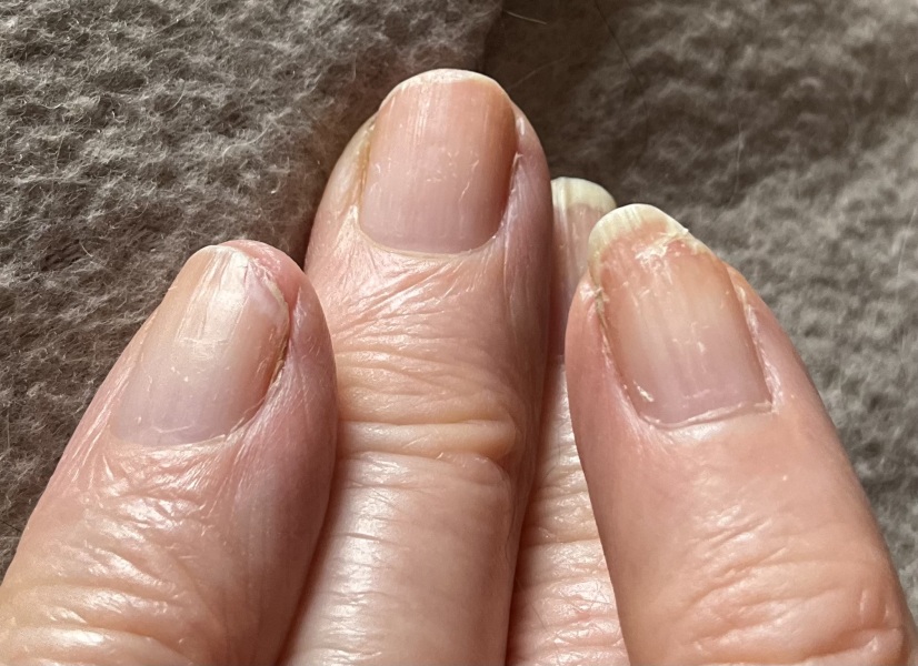 Desperate nail help!!!'