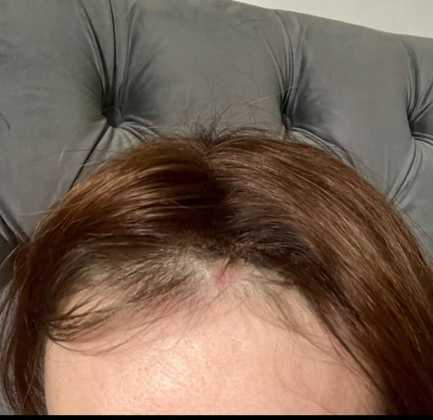 Hair Mesh Integration System