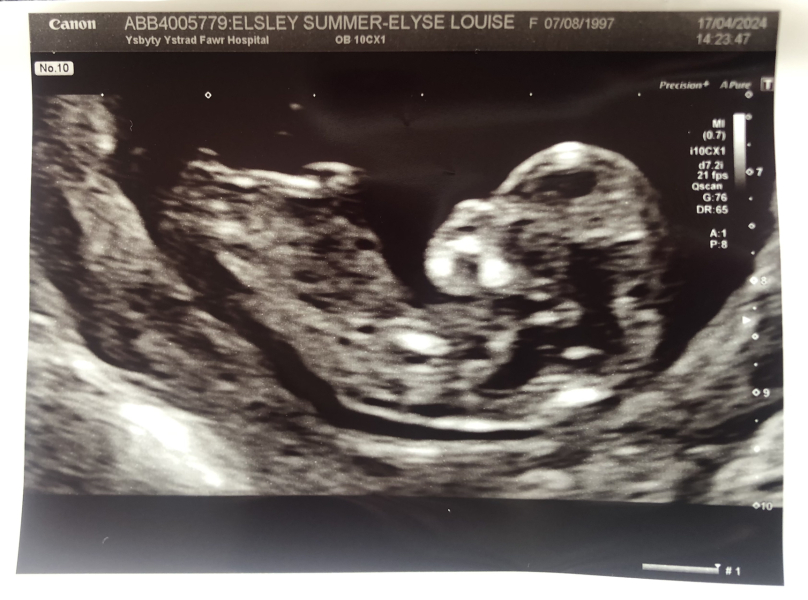 OCTOBER 2024 BABIES :) THREAD 3