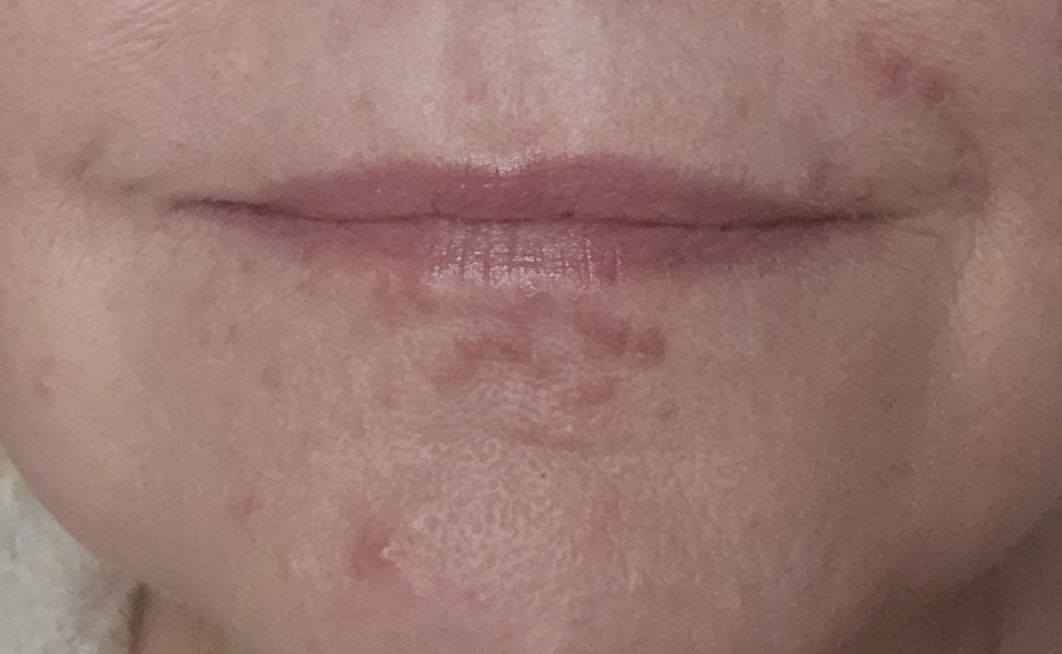 Skin mystery - help!