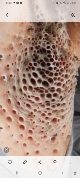 I think I have the opposite of Trypophobia *Trigger Warning*