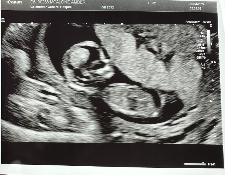 OCTOBER 2024 BABIES :) THREAD 3