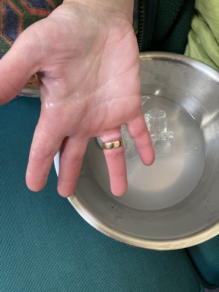 I have a date and I can't get my wedding and engagement rings off...