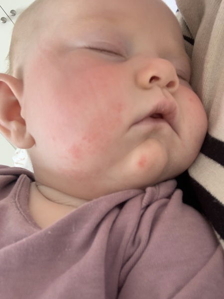 What could this rash be?