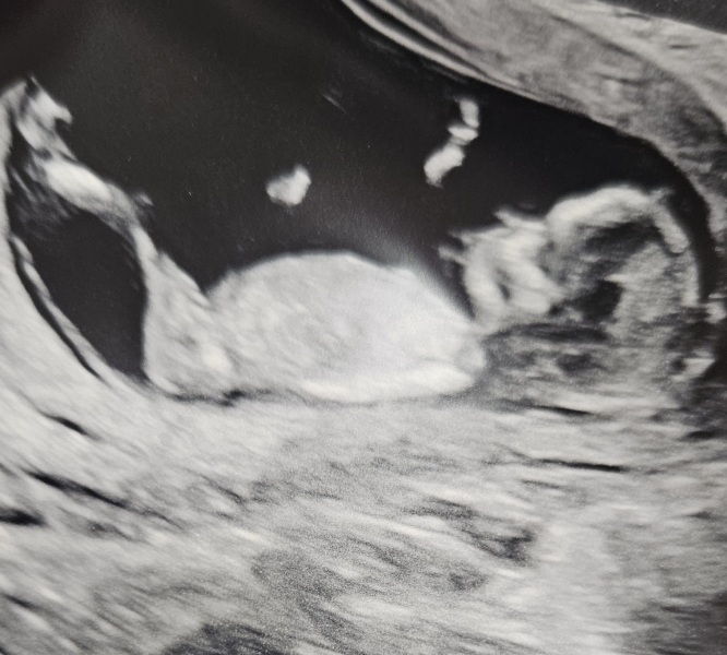 TTC May 2023 💝 Previous MC March 2023 (thread 4)