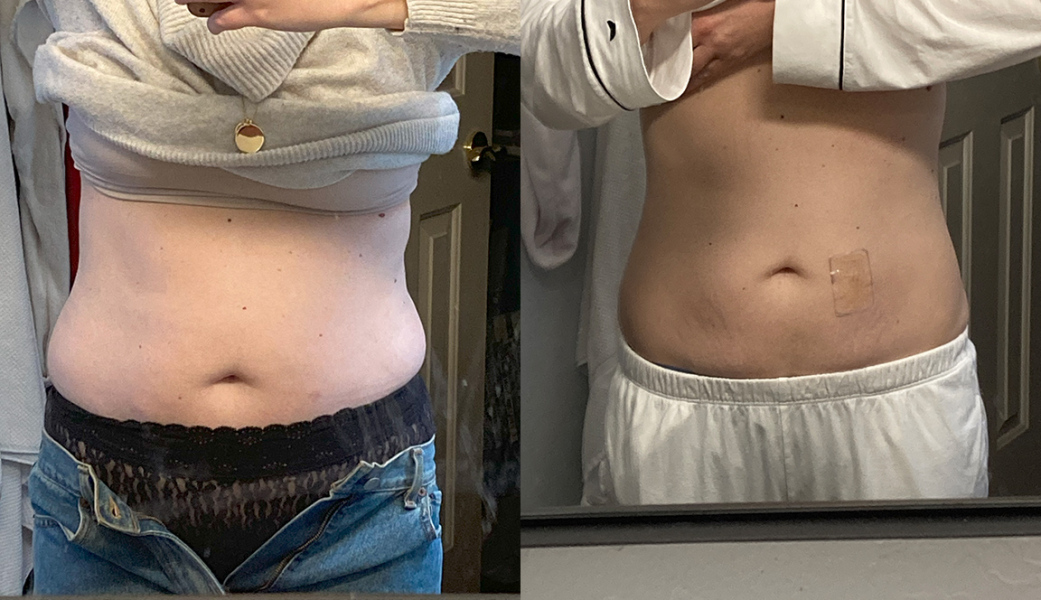 Calling the Louise Parker Method folk!