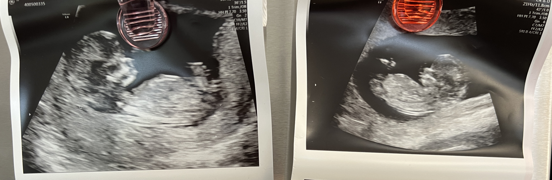 OCTOBER 2024 BABIES :) THREAD 3