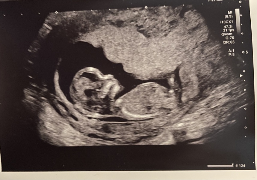 Boy or girl…what do we think?