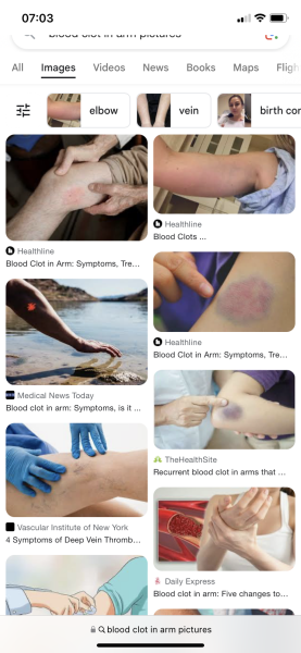 To ask medical people to look at this …