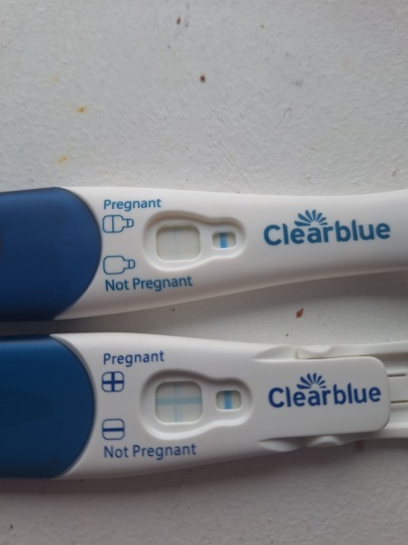 Pregnancy/ pcos