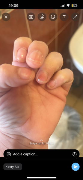 Looking for knowledge on skin cancer