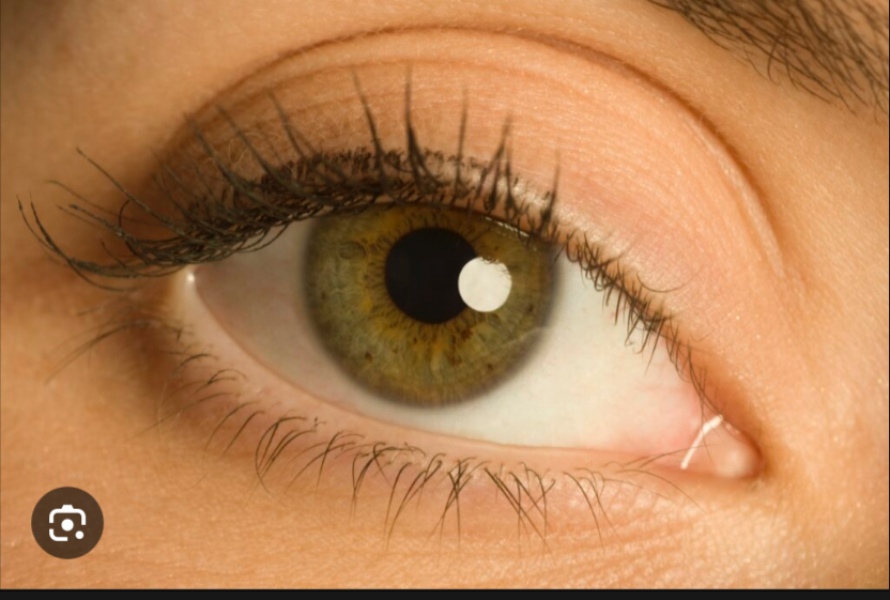 Eye colour, what would you say this is?