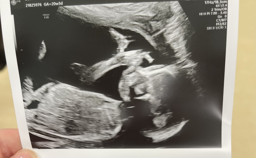 September 2024 - Thread 6! 🐣🧡💛❤️