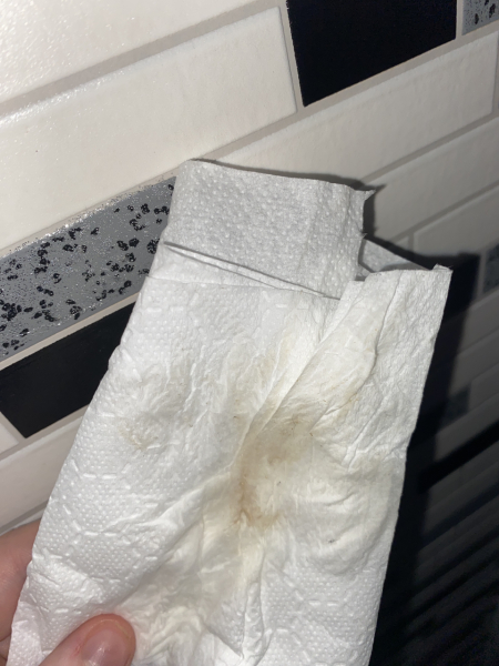 Implantation Dip OR Oestrogen Dip???