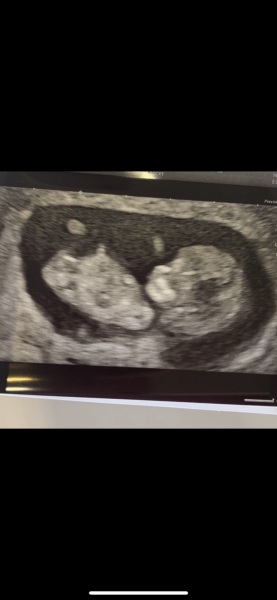 Is this a boy or girl