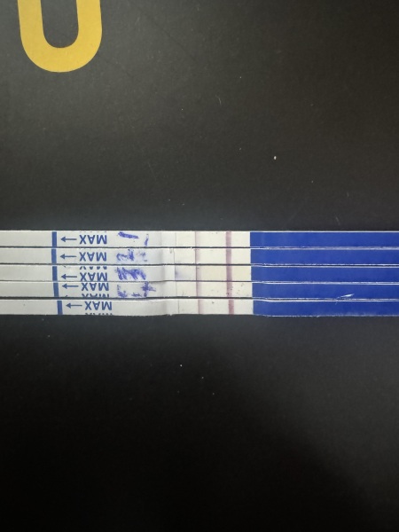 Lower back pain and no progression line