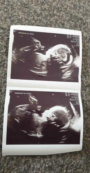 September 2024 - Thread 6! 🐣🧡💛❤️