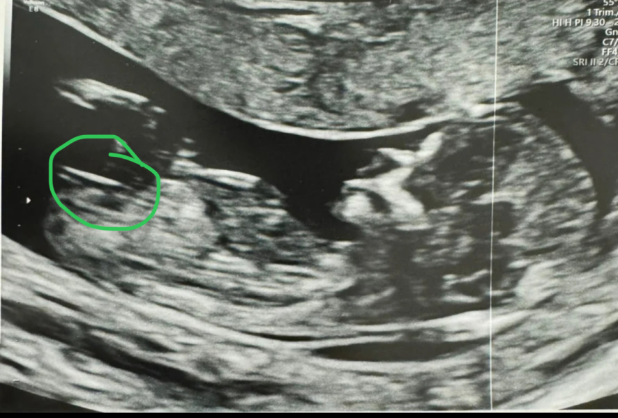 OCTOBER 2024 BABIES - Thread 4