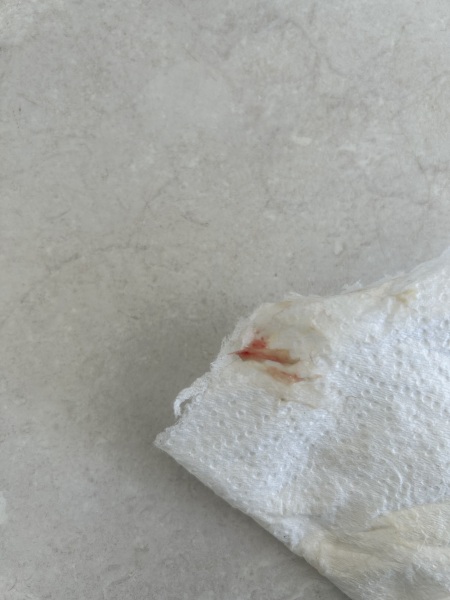 Blood in discharge TMI
