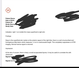 Mri results for lump I had any advice