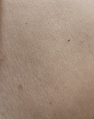 What are these red marks and can I remove them