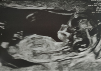 Anyone want me to take a look at their nubs?