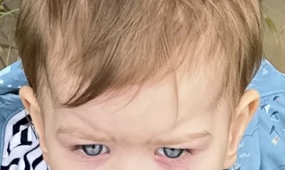 Is this normal development?