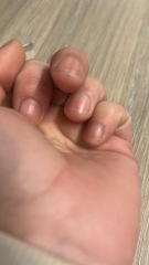 Looking for knowledge on skin cancer