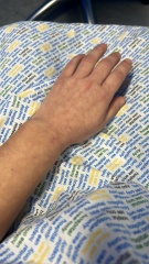 Looking for knowledge on skin cancer