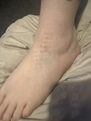 Dots on foot