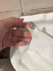 Warning TMI photos - is this my mucus plug?