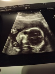 Anyone want me to take a look at their nubs?